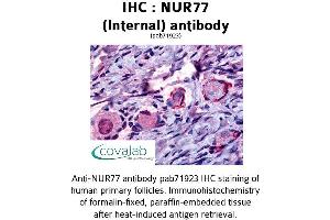 Image no. 1 for anti-Nuclear Receptor Subfamily 4, Group A, Member 1 (NR4A1) (Internal Region) antibody (ABIN1737603) (NR4A1 anticorps  (Internal Region))