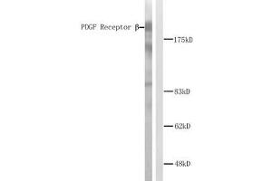 Western blot analysis of extracts from NIH/3T3 cells. (PDGFRB anticorps)