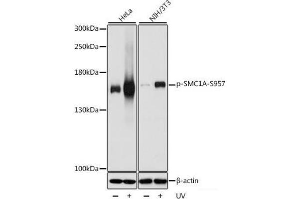 SMC1A anticorps  (pSer957)