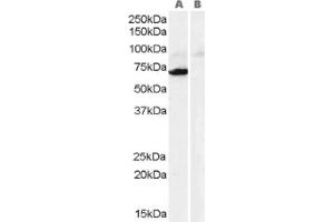 Image no. 1 for anti-Monoamine Oxidase A (MAOA) (Internal Region) antibody (ABIN374605) (Monoamine Oxidase A anticorps  (Internal Region))