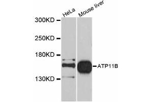 Western blot analysis of extracts of various cell lines, using ATP11B antibody (ABIN5997278) at 1/1000 dilution. (ATP11B anticorps)
