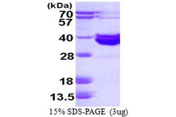 ABO Protein (AA 54-354) (His tag)