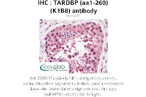 Image no. 2 for anti-TAR DNA Binding Protein (TARDBP) (AA 1-260) antibody (ABIN1723216) (TARDBP anticorps  (AA 1-260))