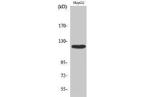 Western Blotting (WB) image for anti-PTK2 Protein tyrosine Kinase 2 (PTK2) (Thr433) antibody (ABIN3184579) (FAK anticorps  (Thr433))