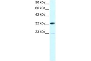 Western Blotting (WB) image for anti-Chromobox Homolog 4 (CBX4) antibody (ABIN2460142) (CBX4 anticorps)
