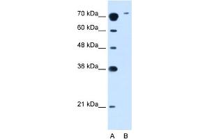 WB Suggested Anti-SLC7A14 Antibody Titration:  2. (SLC7A14 anticorps  (N-Term))