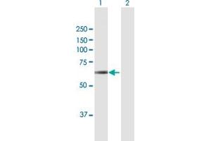 Western Blot analysis of PICALM expression in transfected 293T cell line by PICALM MaxPab polyclonal antibody. (PICALM anticorps  (AA 1-610))