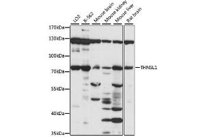 Western blot analysis of extracts of various cell lines, using THNSL1 antibody (ABIN6293622) at 1:1000 dilution. (THNSL1 anticorps)