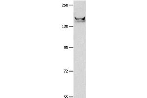 Western Blot analysis of Mouse brain tissue using GRIN2B Polyclonal Antibody at dilution of 1:700 (GRIN2B anticorps)