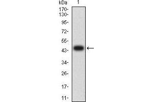 Western Blotting (WB) image for anti-Platelet Derived Growth Factor Receptor alpha (PDGFRA) (AA 179-361) antibody (ABIN5611263)