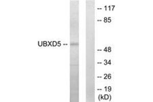 Western blot analysis of extracts from HepG2 cells, using UBXD5 Antibody. (UBXN11 anticorps  (AA 131-180))