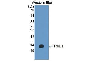 Western blot analysis of the recombinant protein. (Anoctamin 6 anticorps  (AA 744-824))