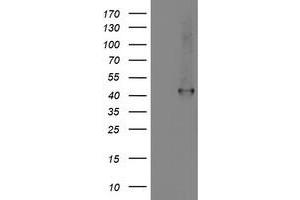 HEK293T cells were transfected with the pCMV6-ENTRY control (Left lane) or pCMV6-ENTRY SMS (Right lane) cDNA for 48 hrs and lysed. (SMS anticorps)