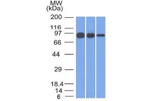 Western Blot of A431, A549 and MCF-7 cell lysates using Catenin, beta Mouse Monoclonal Antibody (12F7) (CTNNB1 anticorps  (N-Term))