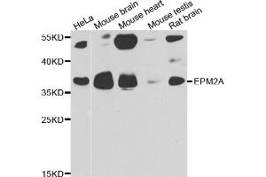 Western blot analysis of extracts of various cell lines, using EPM2A antibody. (EPM2A anticorps)