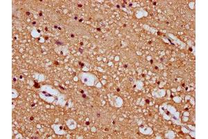IHC image of ABIN7168823 diluted at 1:100 and staining in paraffin-embedded human brain tissue performed on a Leica BondTM system. (SEMA6B anticorps  (AA 756-888))