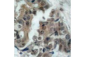 Image no. 2 for anti-BCL2-Associated Agonist of Cell Death (BAD) (pSer136), (pSer99) antibody (ABIN317969) (BAD anticorps  (pSer99, pSer136))