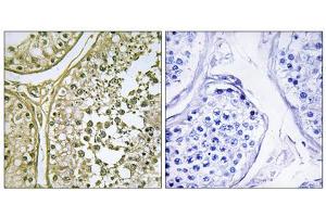 Immunohistochemistry analysis of paraffin-embedded human testis tissue, using CKI- alpha 1/L antibody. (CSNK1A1L anticorps  (Internal Region))