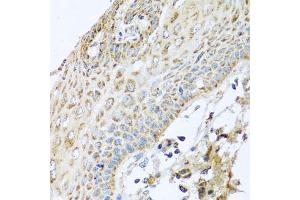 Immunohistochemistry of paraffin-embedded human esophagus using NDUFA2 antibody (ABIN5974497) at dilution of 1/100 (40x lens). (NDUFA2 anticorps)