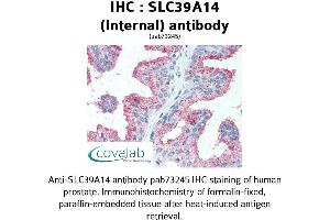 Image no. 2 for anti-Solute Carrier Family 39 (Zinc Transporter), Member 14 (SLC39A14) (Internal Region) antibody (ABIN1739370) (SLC39A14 anticorps  (Internal Region))