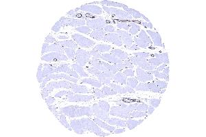 Skeletal muscle In skeletal muscle endothelial vWF immunostaining is strong in postcapillary venules and somewhat weaker in capillaries (Recombinant VWF anticorps  (AA 1815-1939))