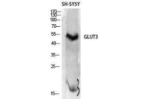 Western Blotting (WB) image for anti-Solute Carrier Family 2 (Facilitated Glucose Transporter), Member 3 (SLC2A3) (C-Term) antibody (ABIN3175292) (SLC2A3 anticorps  (C-Term))