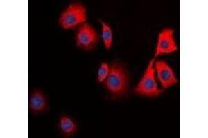 Immunofluorescent analysis of TPH1 staining in HuvEc cells. (Tryptophan Hydroxylase 1 anticorps)