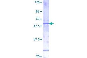 Image no. 1 for Interleukin 11 (IL11) (AA 1-199) protein (GST tag) (ABIN1307670) (IL-11 Protein (AA 1-199) (GST tag))