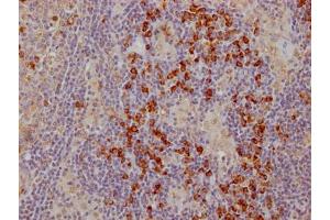 IHC image of ABIN7127437 diluted at 1:100 and staining in paraffin-embedded human lymph node tissue performed on a Leica BondTM system. (Recombinant CTLA4 anticorps)