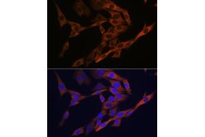 Immunofluorescence analysis of C6 cells using  Rabbit mAb (ABIN6134271, ABIN6138179, ABIN6138182 and ABIN7101399) at dilution of 1:100 (40x lens). (AGR2 anticorps)