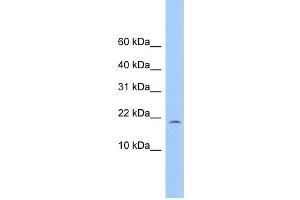 WB Suggested Anti-C10orf83 Antibody Titration: 0. (MORN4 anticorps  (Middle Region))