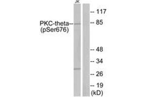 Western Blotting (WB) image for anti-Protein Kinase C, theta (PRKCQ) (pSer676) antibody (ABIN2888514) (PKC theta anticorps  (pSer676))