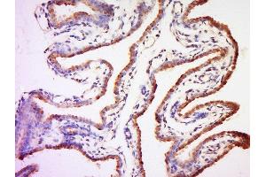 Formalin-fixed and paraffin embedded mouse placenta labeled with Anti-MC4 Receptor Polyclonal Antibody, Unconjugated  at 1:200 followed by conjugation to the secondary antibody and DAB staining. (MC4R anticorps  (AA 1-50))