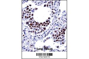 ARIH2 Antibody immunohistochemistry analysis in formalin fixed and paraffin embedded human lung tissue followed by peroxidase conjugation of the secondary antibody and DAB staining. (ARIH2 anticorps  (C-Term))