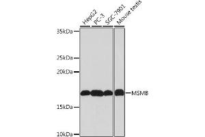 Western blot analysis of extracts of various cell lines, using MSMB Rabbit mAb (ABIN1681107, ABIN3018643, ABIN3018644 and ABIN7101636) at 1:1000 dilution. (MSMB anticorps)