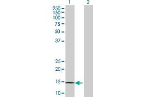 Lane 1: PTGES transfected lysate ( 17. (PTGES 293T Cell Transient Overexpression Lysate(Denatured))