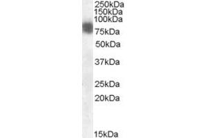 ABIN184659 (0. (Cortactin anticorps  (N-Term))