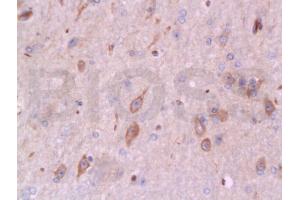 Immunohistochemistry (IHC) image for anti-BCL2-Associated X Protein (BAX) (AA 84-175) antibody (ABIN725390)