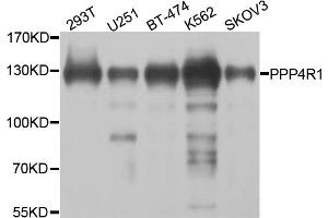 Western blot analysis of extracts of various cell lines, using PPP4R1 antibody (ABIN5974671) at 1/1000 dilution. (PPP4R1 anticorps)