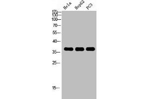 Western Blot analysis of HELA HEPG2 PC-3 using p38 Polyclonal Antibody. (MAPK14 anticorps  (C-Term))