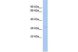 WB Suggested Anti-ODF4 Antibody Titration: 0. (ODF4 anticorps  (N-Term))