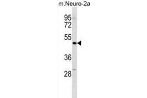 Western Blotting (WB) image for anti-Doublecortin Domain Containing 2 (DCDC2) antibody (ABIN3000420) (DCDC2 anticorps)