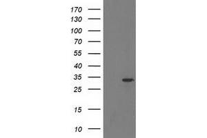 HEK293T cells were transfected with the pCMV6-ENTRY control (Left lane) or pCMV6-ENTRY HDHD2 (Right lane) cDNA for 48 hrs and lysed. (HDHD2 anticorps)