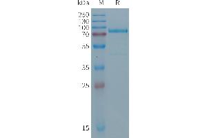 Desmoglein 2 Protein (DSG2) (AA 24-609) (His tag)