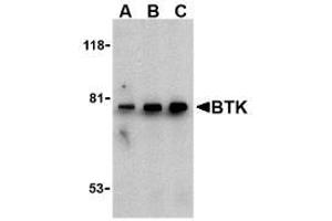 Image no. 2 for anti-Bruton Agammaglobulinemia tyrosine Kinase (BTK) (N-Term) antibody (ABIN206839) (BTK anticorps  (N-Term))