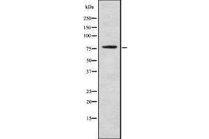 Western blot analysis GOLM1 using Jurkat whole cell lysates (GOLM1 anticorps  (C-Term))