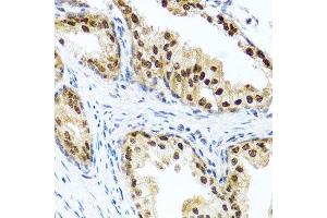 Immunohistochemistry of paraffin-embedded human prostate using RAD23B antibody. (RAD23B anticorps  (AA 50-150))