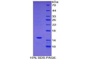 SDS-PAGE analysis of Rat T-Box Protein 3 Protein. (TBX3 Protéine)