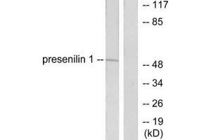 Western Blotting (WB) image for anti-Presenilin 1 (PSEN1) (N-Term) antibody (ABIN1848749) (Presenilin 1 anticorps  (N-Term))