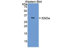 Detection of Recombinant DNMT1, Human using Polyclonal Antibody to DNA Methyltransferase 1 (DNMT1) (DNMT1 anticorps  (AA 1343-1570))